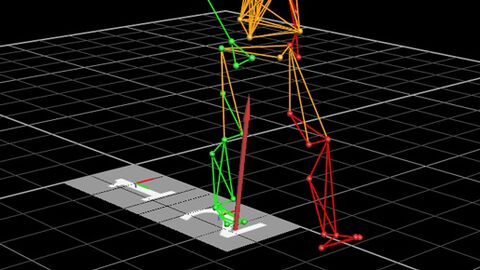Analyse de la marche lors de la rééducation pour l’amélioration de la mobilité des personnes amputées Analyse de la marche lors de la rééducation pour l’amélioration de la mobilité des personnes amputées